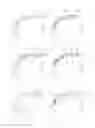 Fig. 08 - Dual capture device for stent graft delivery system and method for capturing a stent graft