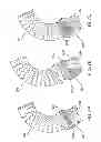 Fig. 07 - Heart valve and endovascular graft components and method for delivery