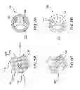 Fig. 08 - Heart valve and endovascular graft components and method for delivery