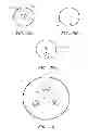 Fig. 07 - METHODS AND DEVICES FOR DELIVERY OF PROSTHETIC HEART VALVES AND OTHER PROSTHETICS