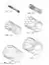 Fig. 02 - Handle mechanism and functionality for repositioning and retrieval of transcatheter heart valves