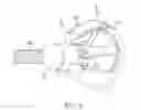 Fig. 09 - CARDIAC VALVE WITH SHIELDS FOR TISSUE RETRACTION