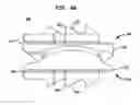 Fig. 08 - Intervertebral disc and insertion methods therefor