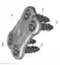 Fig. 09 - Bioactive spinal implants and method of manufacture thereof