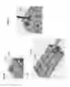 Fig. 49 - Bioactive spinal implants and method of manufacture thereof