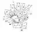 Fig. 01 - Bone prosthesis for maintaining joint operation in complex joints