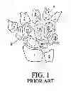 Fig. 02 - Bone prosthesis for maintaining joint operation in complex joints