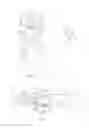 Fig. 02 - Metatarsalphalangeal Joint Apprartus and Method