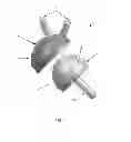 Fig. 02 - PROSTHESIS