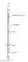 Fig. 01 - Formation tester interval pressure transient test and apparatus