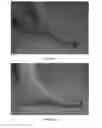 Fig. 02 - Foot orthotic design system