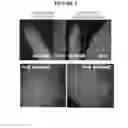 Fig. 04 - Temporal regulation of gene expression by microRNAs