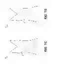 Fig. 07 - Reversible compression garments and methods of assembling and using same