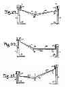 Fig. 15 - PATIENT POSITIONING SUPPORT STRUCTURE