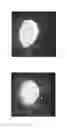 Fig. 02 - DETERGENT GRANULES WITH A WATER-SWELLABLE COMPONENT
