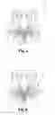 Fig. 03 - Heating device intended for a windscreen wiper and windscreen wiper including such a heating device