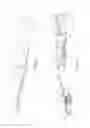 Fig. 03 - Mounting assembly for wiper blade and wiper arm