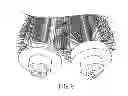 Fig. 09 - Vacuum brush