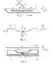 Fig. 02 - Method for producing an antenna element of an RFID transponder