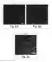 Fig. 09 - Polymorphism and microstructure of certain triacylglycerols and fatty acid methyl esters
