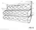 Fig. 08 - Modular Tensile Vegetated Wall System