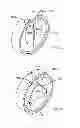 Fig. 06 - Door viewer security cover