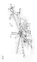 Fig. 02 - Structure repair with polymer matrix composites