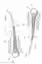 Fig. 05 - Reel finger
