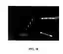Fig. 46 - APPARATUS AND METHOD FOR ASSESSING PERCUTANEOUS IMPLANT INTEGRITY