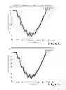 Fig. 47 - APPARATUS AND METHOD FOR ASSESSING PERCUTANEOUS IMPLANT INTEGRITY