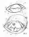 Fig. 04 - Device for fluid sampling