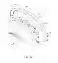 Fig. 04 - Braiding mechanism and methods of use