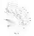 Fig. 06 - Braiding mechanism and methods of use