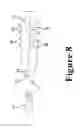 Fig. 09 - Bullet