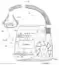 Fig. 01 - Session-by-session adjustment of a device for treating sleep disordered breathing