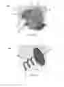 Fig. 03 - Inflation control valves for resuscitator devices and resuscitator devices