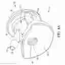 Fig. 07 - Endoscope lens cleaning device