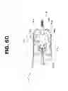 Fig. 20 - Hydrodynamic focusing apparatus and methods