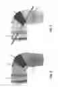 Fig. 05 - WASTE TRANSFER SYSTEM