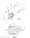 Fig. 12 - Magnetically guided catheters