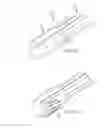 Fig. 13 - Magnetically guided catheters