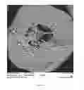 Fig. 19 - Methods for fracturing subterranean formations