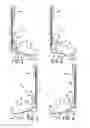 Fig. 03 - Universal mounting bracket for electrical boxes in concrete block walls