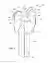 Fig. 02 - Two prong rotary drill bit with cutting insert having edge preparation