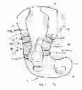 Fig. 16 - Railcar coupler core with vertical parting line and method of manufacture
