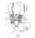 Fig. 17 - Railcar coupler core with vertical parting line and method of manufacture