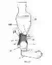 Fig. 21 - Railcar coupler core with vertical parting line and method of manufacture