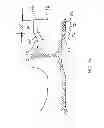 Fig. 25 - Railcar coupler core with vertical parting line and method of manufacture