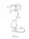 Fig. 27 - Railcar coupler core with vertical parting line and method of manufacture
