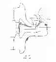 Fig. 38 - Railcar coupler core with vertical parting line and method of manufacture